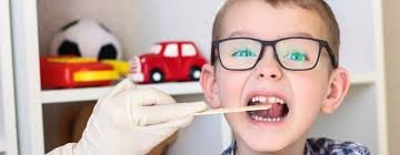 What is Oro-Motor Delay?