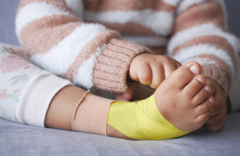 What Is Kinesio Tape